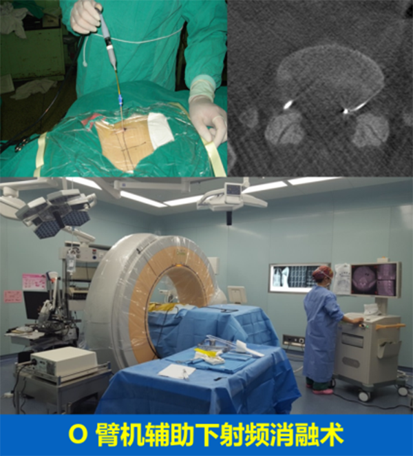 腰椎疾病的微創手術