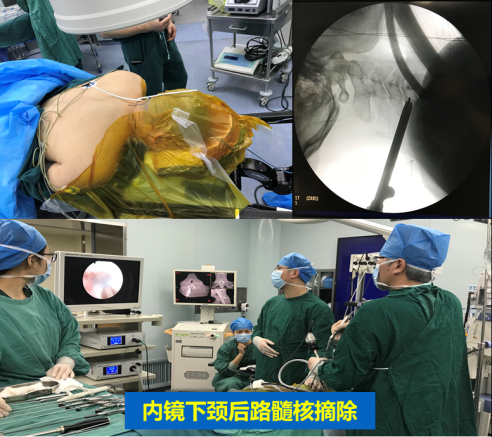 頸椎疾病的手術治療